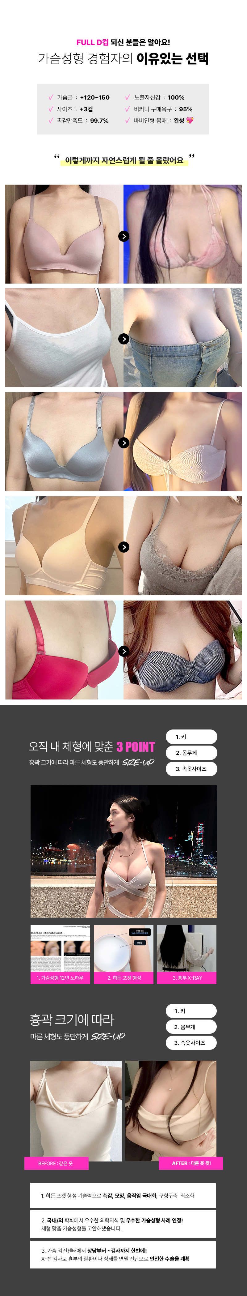 가슴성형 200만원